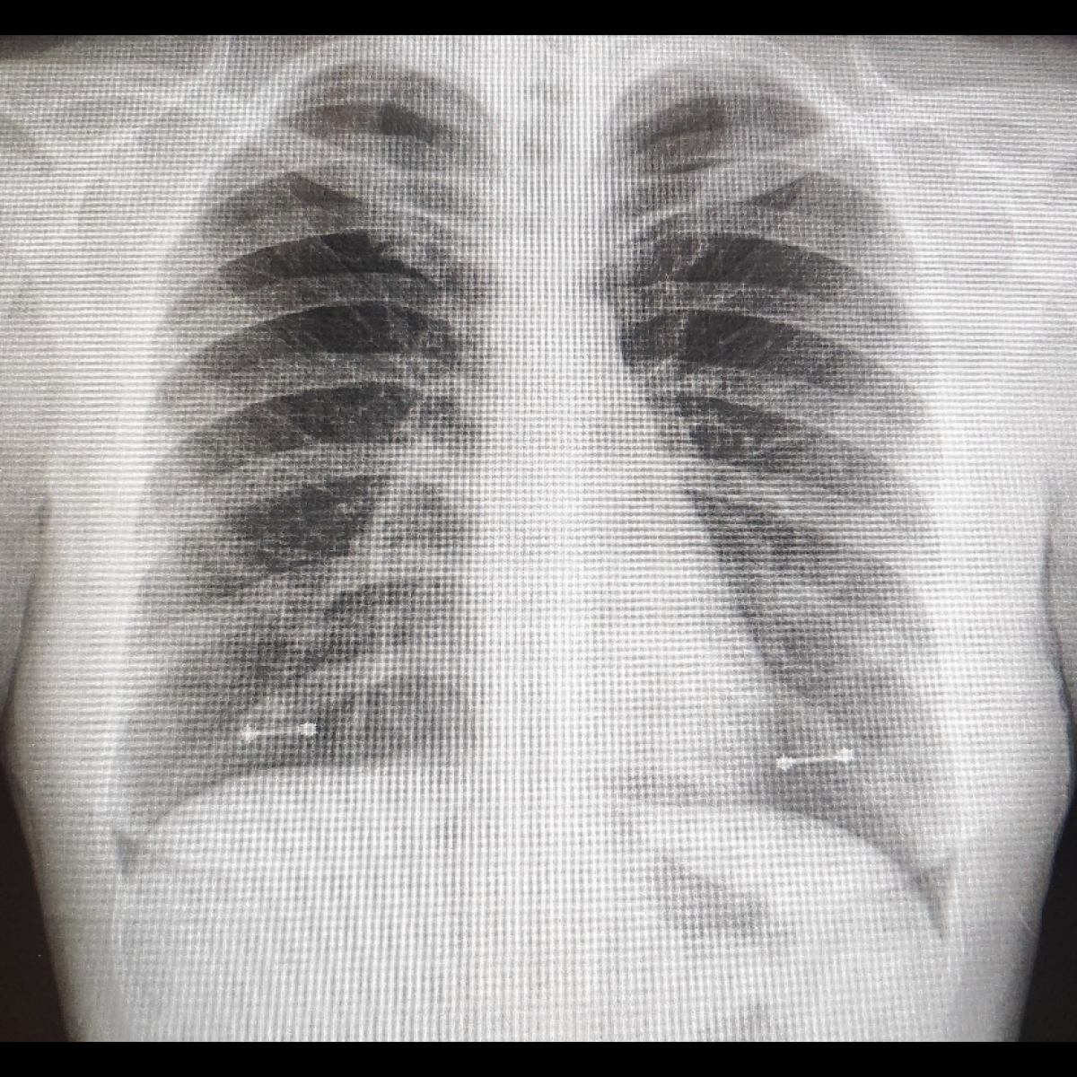 Frankie50569's Photo